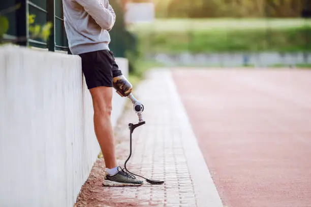 Cut out picture of handsome caucasian sporty handicapped man in sportswear and with artificial leg leaning on fence while holding arms crossed.