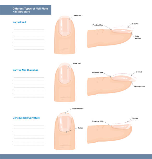 illustrazioni stock, clip art, cartoni animati e icone di tendenza di diversi tipi di lastra per unghie. unghie normali, convesse e concave. guida all'estensione delle unghie. illustrazione vettoriale - manicure