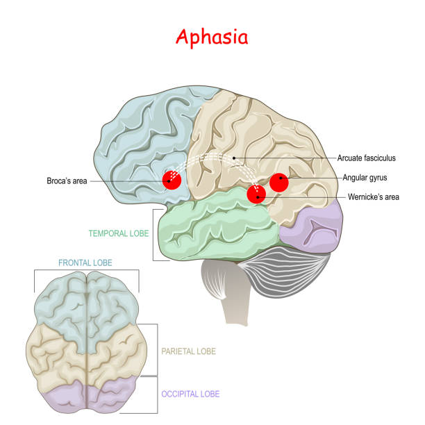 ilustrações de stock, clip art, desenhos animados e ícones de aphasia - frontal lobe