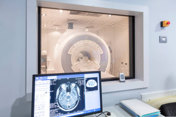 mri スキャナー - mri scanner healthcare and medicine medical exam brain ストックフォトと画像