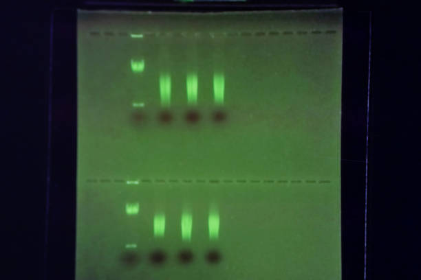 polymerase chain reaction (pcr) und agarose gel elektrophorese ist eine methode der gelelektrophorese in der biochemie, molekularbiologie, genetik und klinischen chemie im labor verwendet. - agarose stock-fotos und bilder