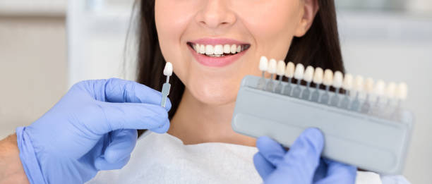 istock Dentist applying sample from tooth scale to happy patient teeth 1181608868