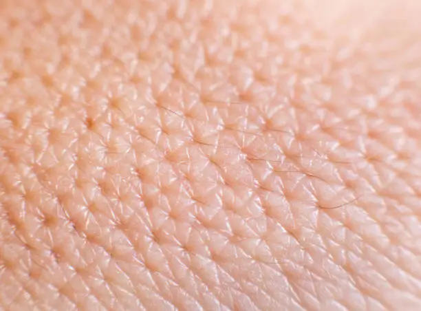 Closeup of porous oily human skin. Large pores on the skin, background, macro, combination skin leather
