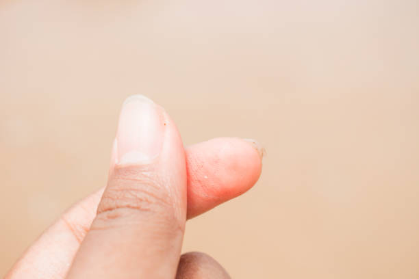 Male hand with ink thumb, after voting.