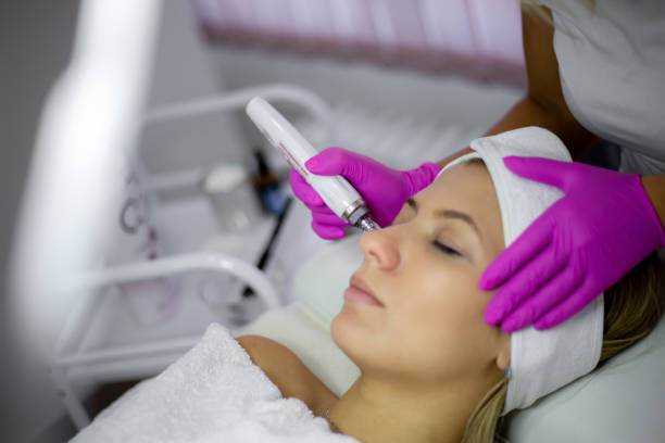 traitement facial avec dermapen dans le salon de beauté - microneedling photos et images de collection