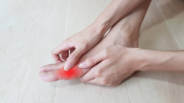 anatomi kaki dengan sorotan merah di area yang menyakitkan. nyeri jari kaki dapat menyebabkan patah tulang, tendinitis, keseleo ligamen, osteoartritis, artritis gouty, rheumatoid arthritis. konsep gejala medis. - asam urat potret stok, foto, & gambar bebas royalti