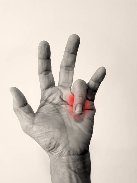 desencadenar la enfermedad de los dedos (bloqueo del dedo o trastorno de tenosinovitis estenosing), anatomía de la mano con resaltado en la zona dolorosa.  el paciente tiene dolor y problemas de captura de dedos. concepto de síntomas médicos - dedo indice fotografías e imágenes de stock