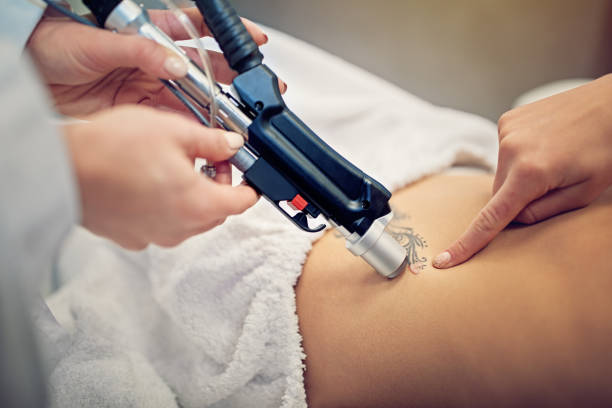 Young woman on laser tattoo removal procedure