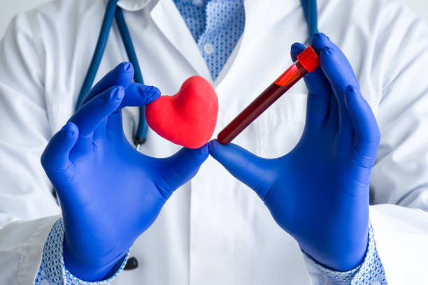 diagnóstico médico de laboratorio, pruebas para el corazón y la foto del concepto cardiovascular. el médico o técnico de laboratorio sostiene en una mano el tubo de ensayo de laboratorio con sangre, por otro lado - figura del corazón - lipoprotein fotografías e imágenes de stock