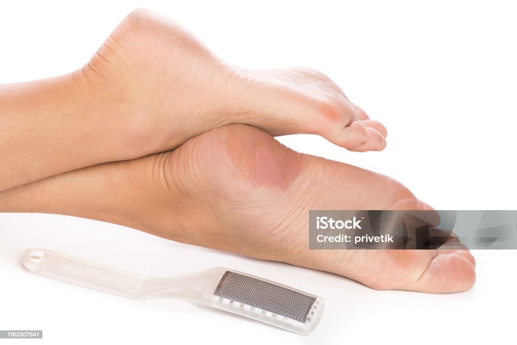 Female Feet And Callus Remover Tool Stock Photo - Download Image Now -  Barefoot, Beautician, Beauty - iStock
