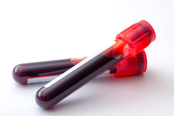 istock Phlebotomy, biochemical analysis, laboratory exam and blood testing concept theme with two test tubes isolated on white background 1182343866