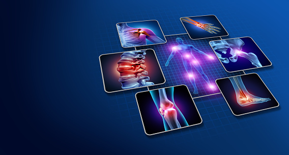 Body joint pain concept as human skeleton and muscle anatomy of the body with a group of sore joints as a painful injury or arthritis illness symbol for health care and medical symptoms with 3D illustration elements.