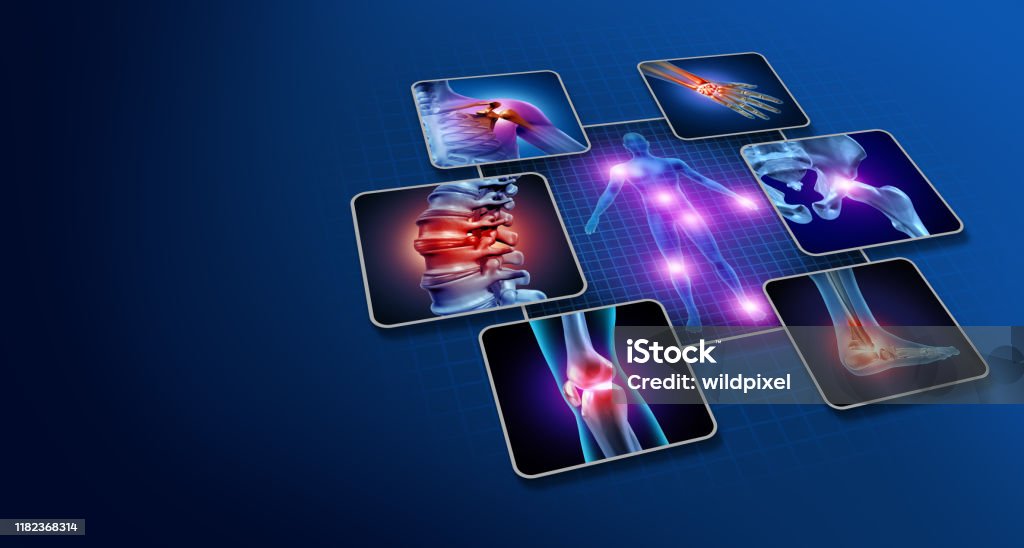 Body Joint Pain Body joint pain concept as human skeleton and muscle anatomy of the body with a group of sore joints as a painful injury or arthritis illness symbol for health care and medical symptoms with 3D illustration elements. Pain Stock Photo