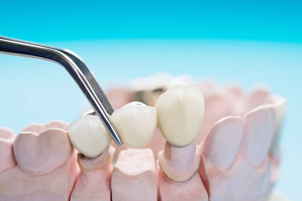 prosthodontics or prosthetic