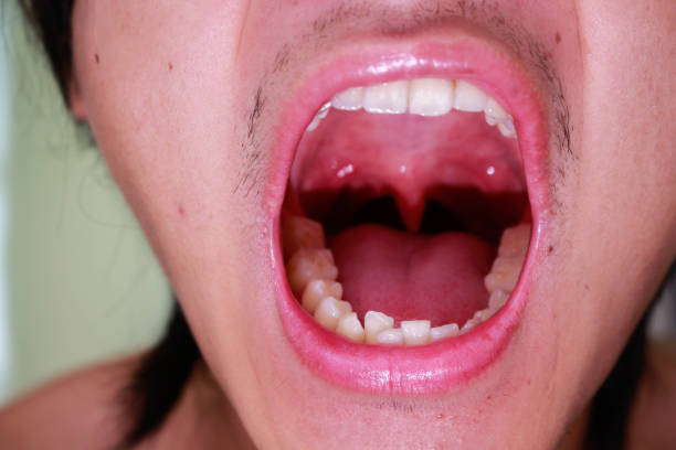 istock Screaming young man with mouth wide open. 1182462955