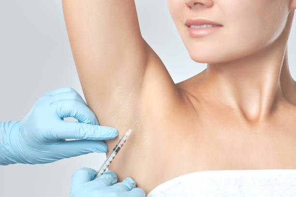 The doctor makes intramuscular injections of botulinum toxin in the underarm area against hyperhidrosis. Cosmetology skin care The doctor makes intramuscular injections of botulinum toxin in the underarm area against hyperhidrosis. Cosmetology skin care sweat gland stock pictures, royalty-free photos & images