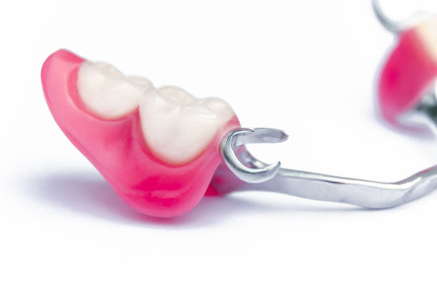 istock part of clasp prosthesis in focus. fixation clamer. false teeth on the lower jaw. removable denture for the lower jaw. orthopedic dentistry 1182482044