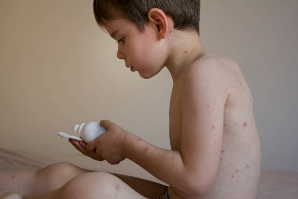 istock Need To Put On Some Medicine 1182550714