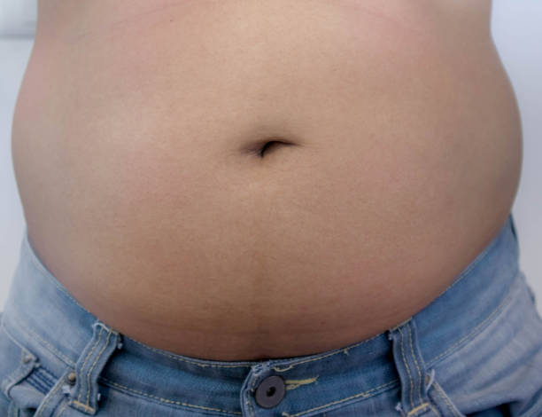 istock Overweight Asian obese men 1182617815