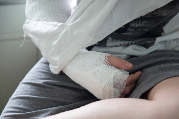 istock A patient with a broken arm is lying in hospital on a bed. 1182718014