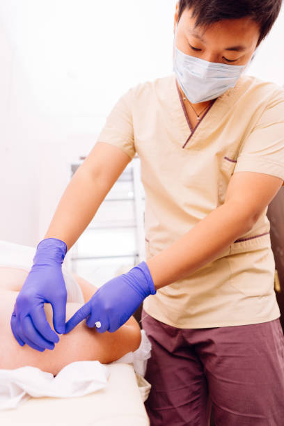 Therapist do acupuncture therapy on woman's body
