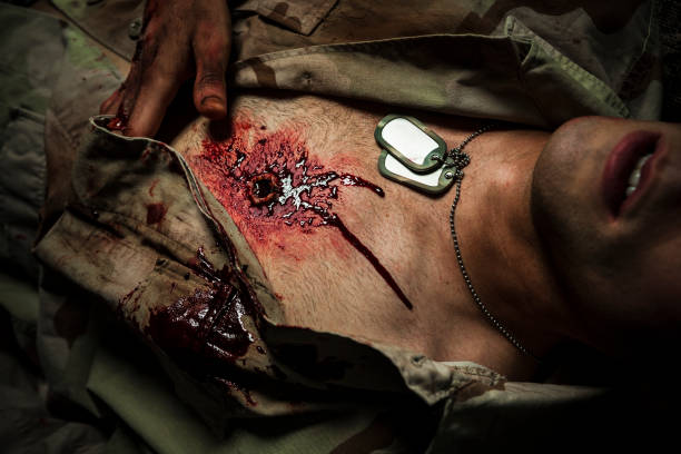 Military Soldier With Gunshot Wound Stock Photo - Download Image Now - Chest - Torso, Physical Injury, Shock - iStock Military Soldier With Gunshot Wound Stock Photo - Download Image Now - Chest - Torso, Physical Injury, Shock - iStock
