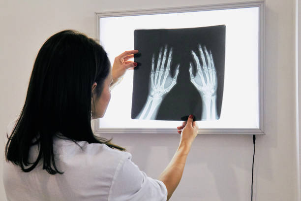 istock Smart woman doctor check hand bones film x-ray image from machine. 1182953915