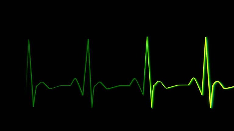 ECG Heartrate Graph Free Motion Graphics & Backgrounds Download Clips Medical ECG Heartrate Graph Free Motion Graphics & Backgrounds Download Clips Medical
