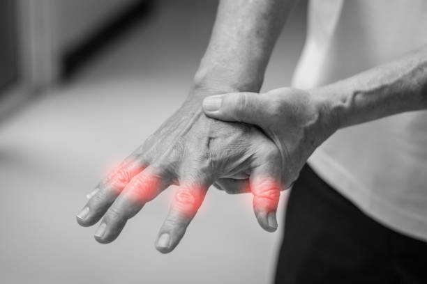 tendinitis überverwendung handprobleme. alte mann hand mit roten fleck o finger als leiden an karpaltunnel-syndrom. die symptome von kribbeln, taubheit, schwäche, oder schmerzen der finger und handgelenk. - fingerknöchel stock-fotos und bilder
