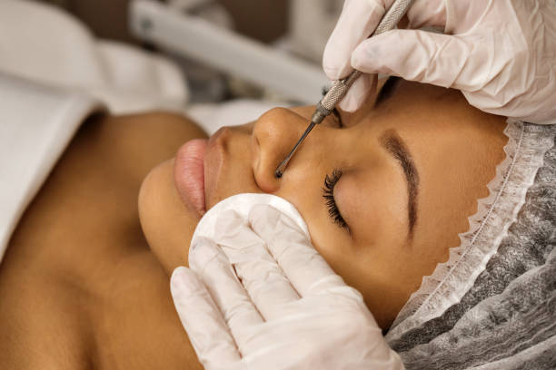 istock Mechanical face cleaning in the beauty salon 1183011304