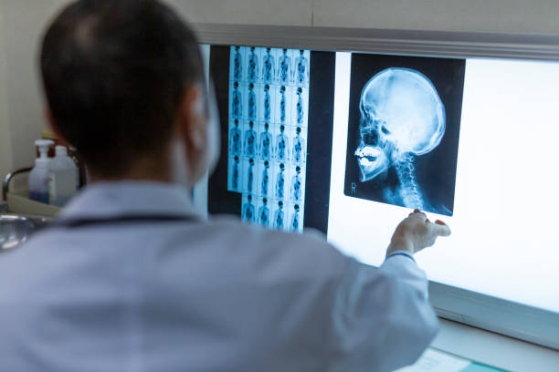 istock Asian Doctor Checking an X-Ray 1183048262