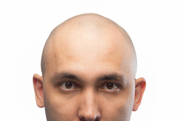 Photo of young shaved man's head on white Photo of young shaved man with different emotions on white background balding photos stock pictures, royalty-free photos & images