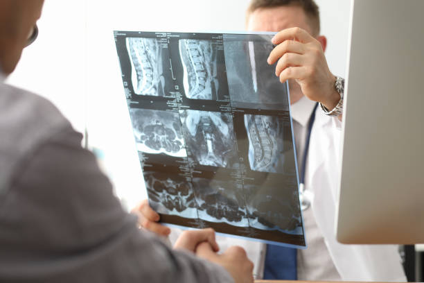 istock Doctor hold xray bone spine radiography in hand 1183253640
