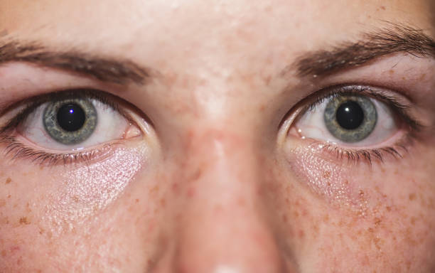 istock Teen eyes 1183261818
