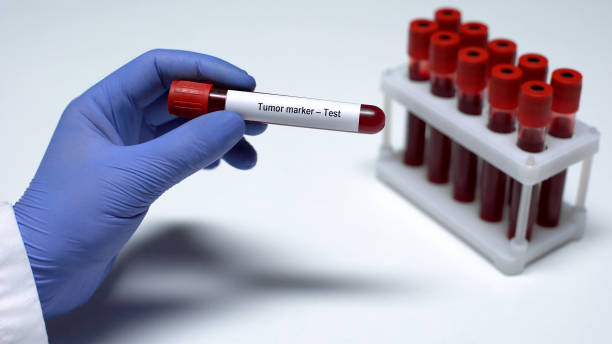 marcador do tumor, doutor que mostra a amostra de sangue no tubo, pesquisa do laboratório, verificação de saúde - medical occupation flash - fotografias e filmes do acervo