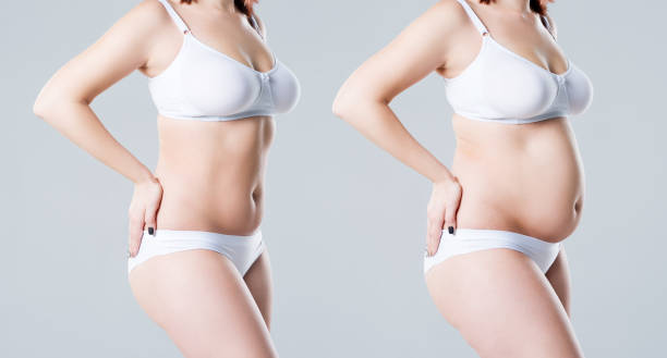 frauenkörper vor und nach gewichtsverlust auf grauem hintergrund - overweight women body abdomen stock-fotos und bilder