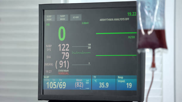 frecuencia cardíaca cero en el monitor ecg en la sala de reanimación, transfusión de sangre, operación - recién nacido 0 1 mes fotografías e imágenes de stock