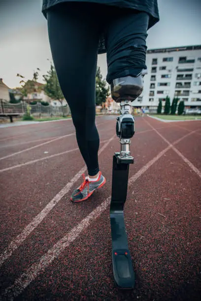 Physically Disabled Athlete With Artificial Leg Preparing For Training At Stadion