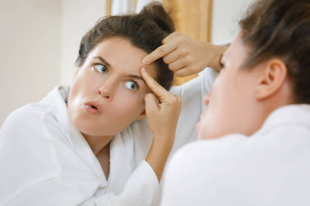 istock Woman squeeze pimples 1183599870
