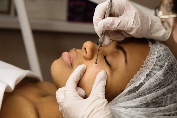istock Mechanical face cleaning in the beauty salon 1183864719