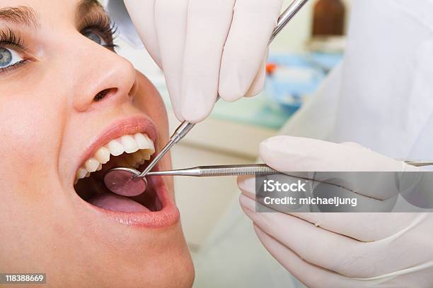 若い女性の歯の検査済である歯科医 - カラー画像のストックフォトや画像を多数ご用意 - カラー画像, クローズアップ, ヒトの口