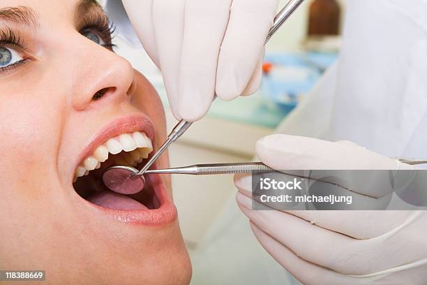 Jovem Mulher Com Dentes Inspeccionado Por Dentista - Fotografias de stock e mais imagens de Aberto - Aberto, Adulto, Boca Humana