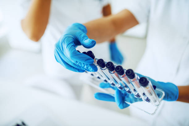 Close up of lab assistant with sterile rubber gloves holding stand with test tubes with blood samples. Close up of lab assistant with sterile rubber gloves holding stand with test tubes with blood samples. ovarian cancer stock pictures, royalty-free photos & images