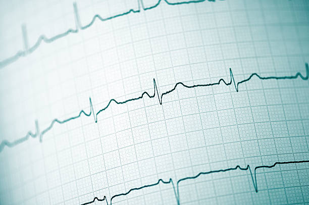 istock Close up of an electrocardiogram 118410248