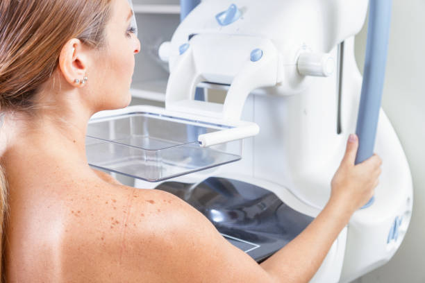istock Woman undergoing medical mammography scan 1184106115