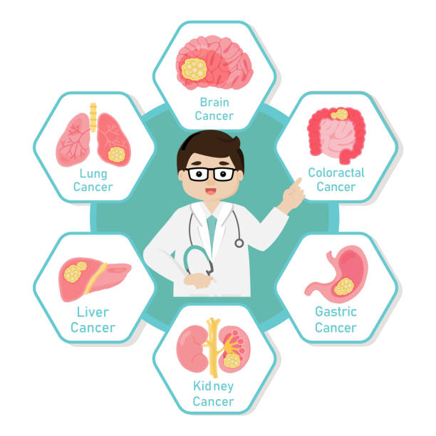 lekarz wprowadza rodzaje raka płaskiej ilustracji wektorowej. - kidney cancer stock illustrations