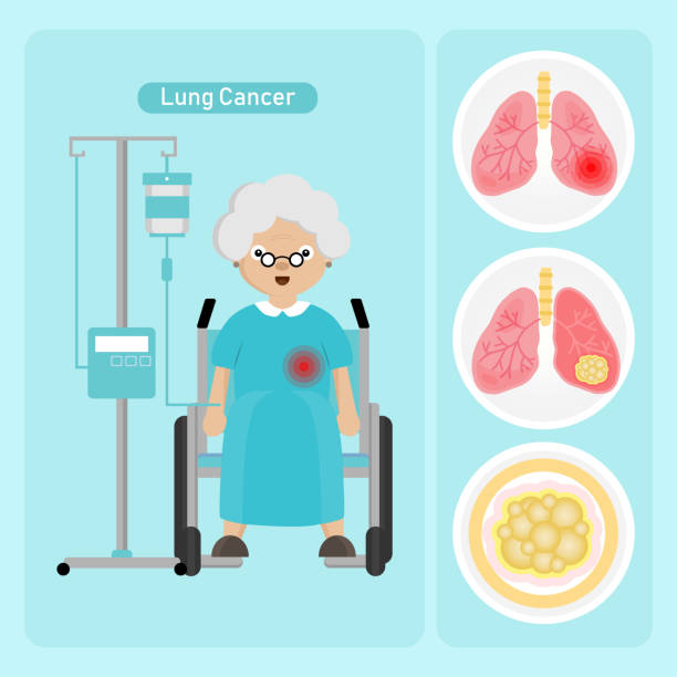 starsza kobieta pacjent z rakiem nerki w stylu kreskówki. - kidney cancer stock illustrations