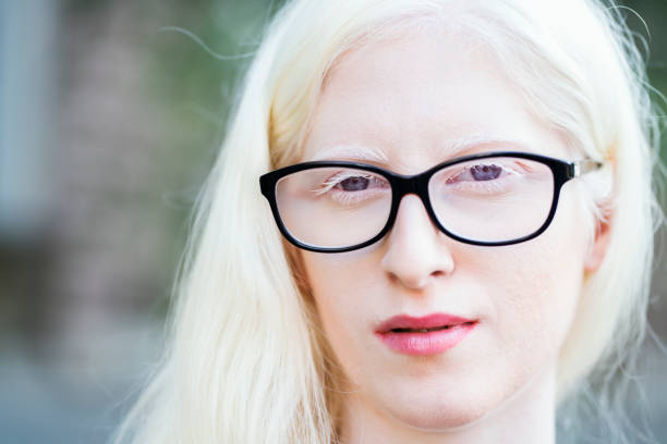Valentines Day portrait of young smiling surprised woman in red sunglasses on the white background. High quality photo.