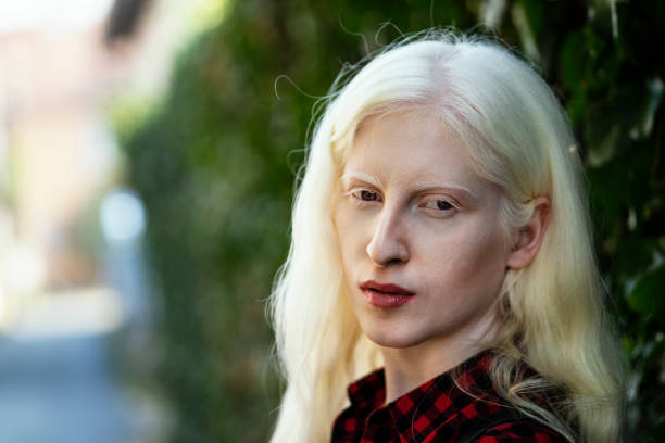 Albino girl Young albino woman pale complexion stock pictures, royalty-free photos & images