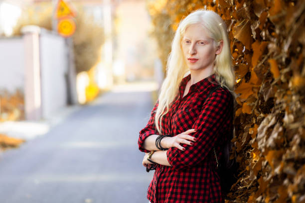 Young albino woman